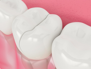 Cracked Tooth Pain causes parramatta