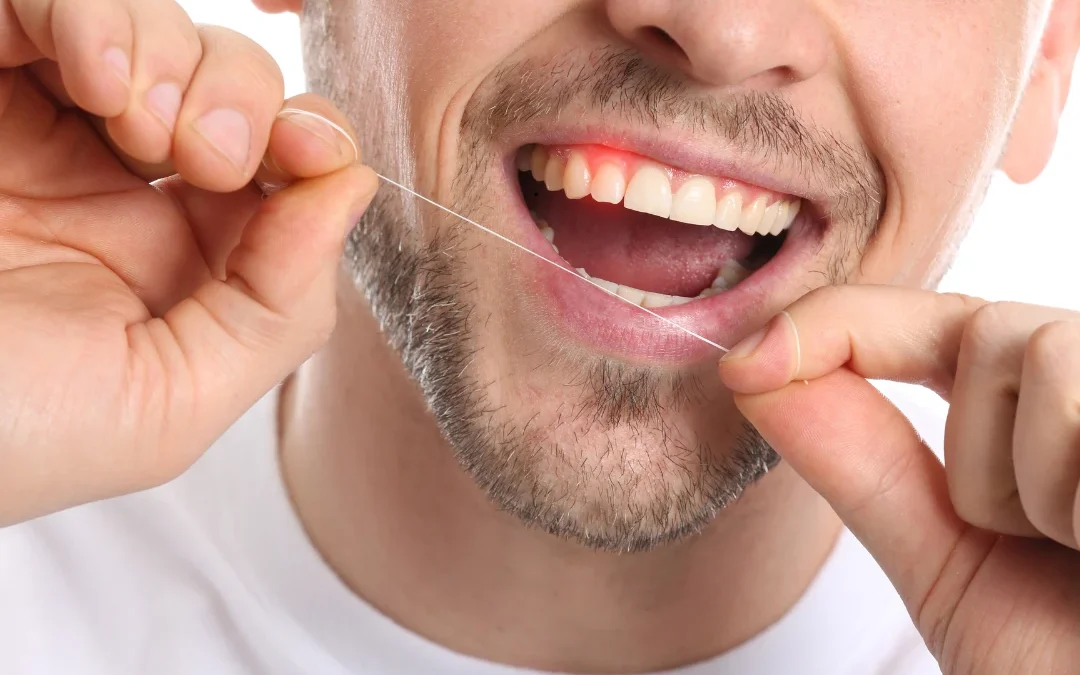 Flossing to Prevent Gum Disease