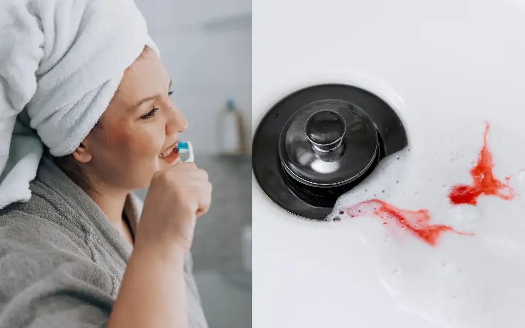 Why Do My Gums Bleed When I Brush My Teeth