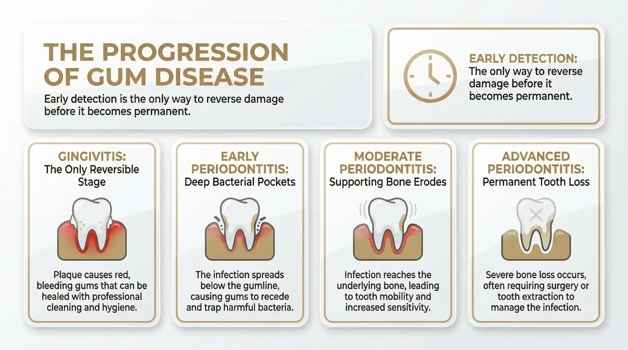 The Stages of Gum Disease: From Gingivitis to Periodontitis