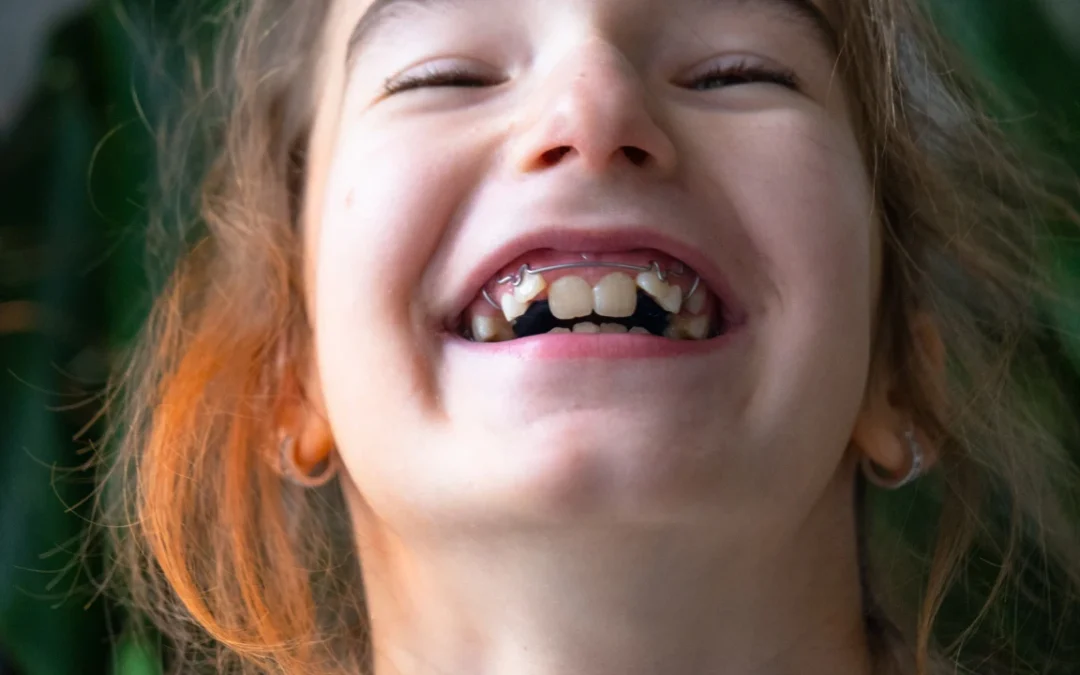 How Long Does Orthodontic Treatment Take