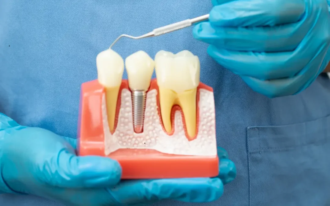 how to prevent a root canal