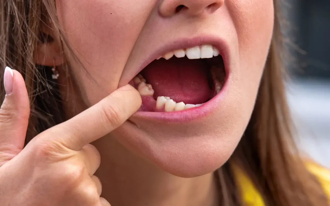 Dry Socket Symptoms