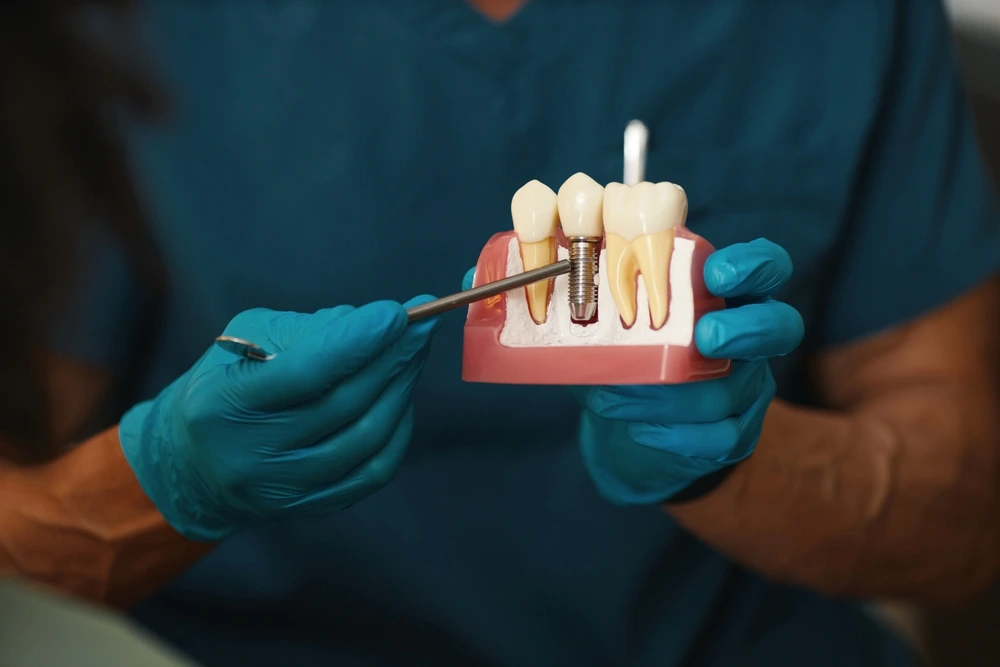 Dentist in blue scrubs demonstrating a dental implant screw and crown model at Parramatta Green Dental clinic.
